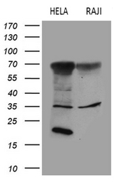FCRLB / FREB-2 Antibody - Western blot analysis of extracts. (35ug) from 2 different cell lines by using anti-FCRLB monoclonal antibody. (1:500)