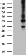 FCRLB / FREB-2 Antibody - HEK293T cells were transfected with the pCMV6-ENTRY control. (Left lane) or pCMV6-ENTRY FCRLB. (Right lane) cDNA for 48 hrs and lysed