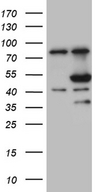 FCRLB / FREB-2 Antibody - HEK293T cells were transfected with the pCMV6-ENTRY control. (Left lane) or pCMV6-ENTRY FCRLB. (Right lane) cDNA for 48 hrs and lysed