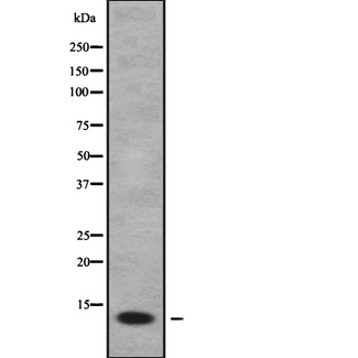 FDC-SP / C4orf7 Antibody - Western blot analysis FDCSP using HepG2 whole cells lysates