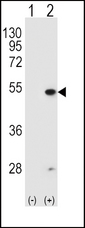 FDFT1 / Squalene Synthase Antibody - Western blot of FDFT1 (arrow) using rabbit polyclonal FDFT1 Antibody (E11). 293 cell lysates (2 ug/lane) either nontransfected (Lane 1) or transiently transfected (Lane 2) with the FDFT1 gene.