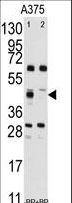 FDFT1 / Squalene Synthase Antibody - Western blot of anti-FDFT1 Antibody pre-incubated without(lane 1) and with(lane 2) blocking peptide (BP2417b) in A375 cell line lysate. FDFT1(arrow) was detected using the purified antibody.