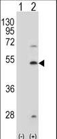 FDFT1 / Squalene Synthase Antibody - Western blot of FDFT1 (arrow) using rabbit polyclonal FDFT1 Antibody (A155). 293 cell lysates (2 ug/lane) either nontransfected (Lane 1) or transiently transfected (Lane 2) with the FDFT1 gene.