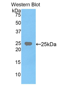 FDFT1 / Squalene Synthase Antibody - Western blot of recombinant FDFT1 / Squalene Synthase.  This image was taken for the unconjugated form of this product. Other forms have not been tested.