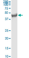 FDFT1 / Squalene Synthase Antibody - FDFT1 monoclonal antibody (M01), clone 3C2. Western Blot analysis of FDFT1 expression in human colon.