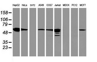 FDFT1 / Squalene Synthase Antibody - Western blot of extracts (35 ug) from 9 different cell lines by using anti-FDFT1 monoclonal antibody.