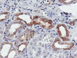 FDFT1 / Squalene Synthase Antibody - IHC of paraffin-embedded Human Kidney tissue using anti-FDFT1 mouse monoclonal antibody.