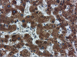 FDFT1 / Squalene Synthase Antibody - IHC of paraffin-embedded Human liver tissue using anti-FDFT1 mouse monoclonal antibody.