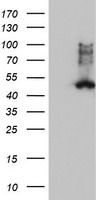 FDFT1 / Squalene Synthase Antibody - HEK293T cells were transfected with the pCMV6-ENTRY control (Left lane) or pCMV6-ENTRY FDFT1 (Right lane) cDNA for 48 hrs and lysed. Equivalent amounts of cell lysates (5 ug per lane) were separated by SDS-PAGE and immunoblotted with anti-FDFT1.