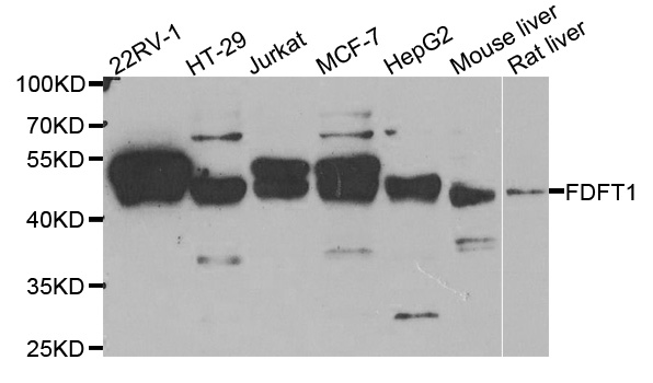 FDFT1 / Squalene Synthase Antibody - Western blot analysis of extracts of various cell lines.