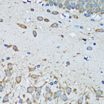 FDFT1 / Squalene Synthase Antibody - Immunohistochemistry of paraffin-embedded mouse brain tissue.