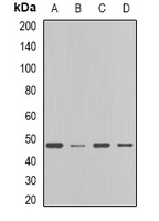 FDFT1 / Squalene Synthase Antibody - Western blot analysis of FDFT1 expression in MCF7 (A); HT29 (B); mouse liver (C); rat liver (D) whole cell lysates.