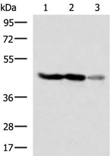 FDFT1 / Squalene Synthase Antibody - Western blot analysis of HT29 and HepG2 cell Human fetal brain tissue lysates  using FDFT1 Polyclonal Antibody at dilution of 1:1000
