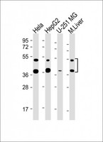 FDPS Antibody - All lanes: Anti-FDPS Antibody (Center) at 1:2000-1:4000 dilution Lane 1: Hela whole cell lysate Lane 2: HepG2 whole cell lysate Lane 3: U-251 MG whole cell lysate Lane 4: Mouse Liver lysate Lysates/proteins at 20 µg per lane. Secondary Goat Anti-mouse IgG, (H+L), Peroxidase conjugated at 1/10000 dilution. Predicted band size: 40, 48 kDa Blocking/Dilution buffer: 5% NFDM/TBST.