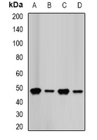 FDPS Antibody - Western blot analysis of FDPS expression in HepG2 (A); HeLa (B); MCF7 (C); mouse liver (D) whole cell lysates.