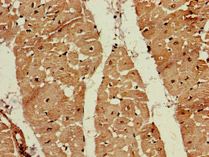 FDPS Antibody - Immunohistochemistry of paraffin-embedded human heart tissue at dilution of 1:100