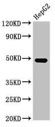 FDPS Antibody - Western Blot Positive WB detected in:HepG2 whole cell lysate All Lanes:FDPS antibody at 3µg/ml Secondary Goat polyclonal to rabbit IgG at 1/50000 dilution Predicted band size: 49,41 KDa Observed band size: 49 KDa