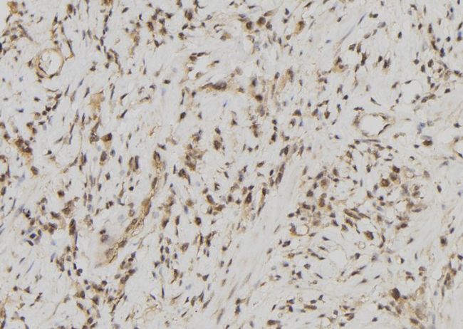 FDPS Antibody - 1:100 staining human gastric tissue by IHC-P. The sample was formaldehyde fixed and a heat mediated antigen retrieval step in citrate buffer was performed. The sample was then blocked and incubated with the antibody for 1.5 hours at 22°C. An HRP conjugated goat anti-rabbit antibody was used as the secondary.