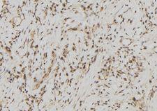 FDPS Antibody - 1:100 staining human gastric tissue by IHC-P. The sample was formaldehyde fixed and a heat mediated antigen retrieval step in citrate buffer was performed. The sample was then blocked and incubated with the antibody for 1.5 hours at 22°C. An HRP conjugated goat anti-rabbit antibody was used as the secondary.