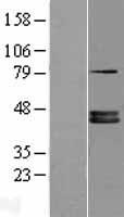 FDPS Protein - Western validation with an anti-DDK antibody * L: Control HEK293 lysate R: Over-expression lysate