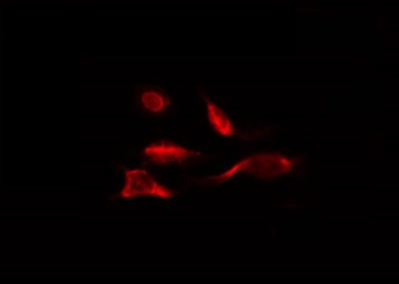 FDX1 / ADX Antibody - Staining HepG2 cells by IF/ICC. The samples were fixed with PFA and permeabilized in 0.1% Triton X-100, then blocked in 10% serum for 45 min at 25°C. The primary antibody was diluted at 1:200 and incubated with the sample for 1 hour at 37°C. An Alexa Fluor 594 conjugated goat anti-rabbit IgG (H+L) Ab, diluted at 1/600, was used as the secondary antibody.