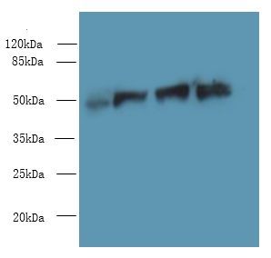 FDXR Antibody - Western blot. All lanes: FDXR antibody at 6 ug/ml. Lane 1: A549 whole cell lysate. Lane 2: Mouse liver tissue. Lane 3: HepG-2 whole cell lysate. Lane 4: U251 whole cell lysate. Secondary Goat polyclonal to Rabbit IgG at 1:10000 dilution. Predicted band size: 54 kDa. Observed band size: 54 kDa.