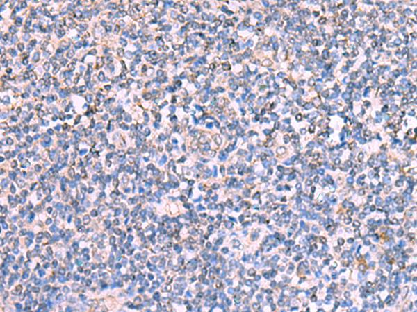 FDXR Antibody - Immunohistochemistry of paraffin-embedded Human tonsil tissue  using FDXR Polyclonal Antibody at dilution of 1:110(×200)