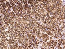 FDXR Antibody - Immunochemical staining of human FDXR in human adrenal gland with rabbit polyclonal antibody at 1:500 dilution, formalin-fixed paraffin embedded sections.