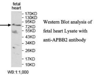 FE65L1 / APBB2 Antibody - Western blot of FE65L1 / APBB2 antibody