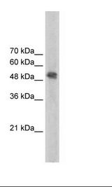 FECH / Ferrochelatase Antibody - Jurkat Cell Lysate.  This image was taken for the unconjugated form of this product. Other forms have not been tested.