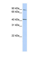 FECH / Ferrochelatase Antibody - FECH antibody Western blot of MCF7 cell lysate. This image was taken for the unconjugated form of this product. Other forms have not been tested.