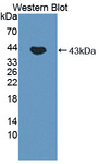 FECH / Ferrochelatase Antibody - Western blot of FECH / Ferrochelatase antibody.