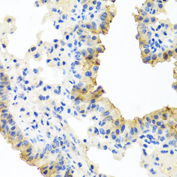 FECH / Ferrochelatase Antibody - Immunohistochemistry of paraffin-embedded mouse lung using FECH antibody at dilution of 1:100 (x40 lens).