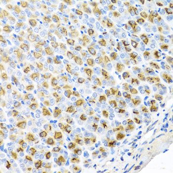 FECH / Ferrochelatase Antibody - Immunohistochemistry of paraffin-embedded mouse stomach using FECH antibody at dilution of 1:100 (x40 lens).