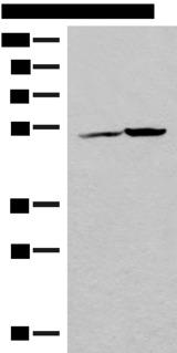 FECH / Ferrochelatase Antibody - Western blot analysis of K562 cell and Human heart tissue lysates  using FECH Polyclonal Antibody at dilution of 1:500