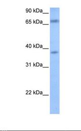 FEM1B Antibody - 721_B cell lysate. Antibody concentration: 1.0 ug/ml. Gel concentration: 12%.  This image was taken for the unconjugated form of this product. Other forms have not been tested.