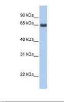 FEM1B Antibody - Fetal lung lysate. Antibody concentration: 1.0 ug/ml. Gel concentration: 12%.  This image was taken for the unconjugated form of this product. Other forms have not been tested.