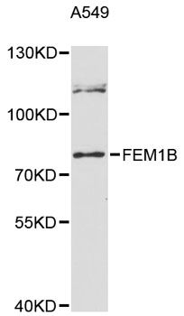 FEM1B Antibody - Western blot analysis of extracts of A-549 cells, using FEM1B antibody at 1:3000 dilution. The secondary antibody used was an HRP Goat Anti-Rabbit IgG (H+L) at 1:10000 dilution. Lysates were loaded 25ug per lane and 3% nonfat dry milk in TBST was used for blocking. An ECL Kit was used for detection and the exposure time was 90s.
