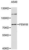 FEM1B Antibody - Western blot analysis of extracts of A-549 cells, using FEM1B antibody at 1:3000 dilution. The secondary antibody used was an HRP Goat Anti-Rabbit IgG (H+L) at 1:10000 dilution. Lysates were loaded 25ug per lane and 3% nonfat dry milk in TBST was used for blocking. An ECL Kit was used for detection and the exposure time was 90s.