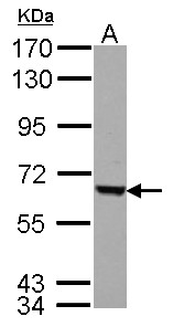FEM1C Antibody - Sample (30 ug of whole cell lysate) A: HepG2 7.5% SDS PAGE FEM1C antibody diluted at 1:5000
