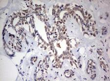 FEN1 Antibody - IHC of paraffin-embedded Human breast tissue using anti-FEN1 mouse monoclonal antibody. (Heat-induced epitope retrieval by 10mM citric buffer, pH6.0, 120°C for 3min).