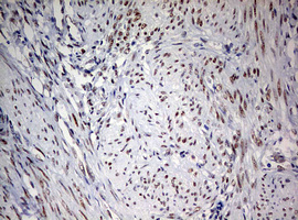FEN1 Antibody - IHC of paraffin-embedded Human endometrium tissue using anti-FEN1 mouse monoclonal antibody. (Heat-induced epitope retrieval by 10mM citric buffer, pH6.0, 120°C for 3min).