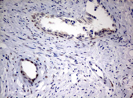 FEN1 Antibody - IHC of paraffin-embedded Human prostate tissue using anti-FEN1 mouse monoclonal antibody. (Heat-induced epitope retrieval by 10mM citric buffer, pH6.0, 120°C for 3min).