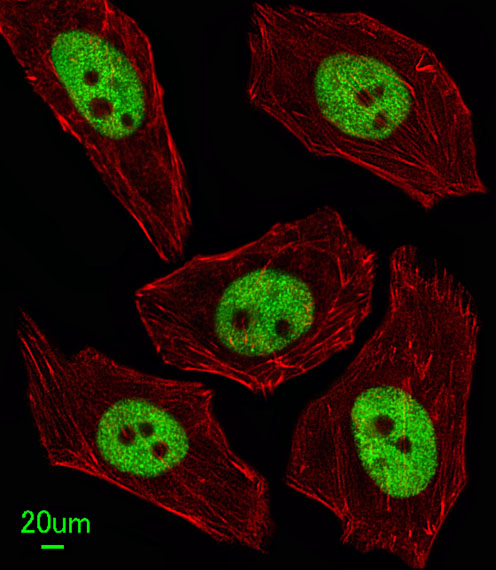 FEN1 Antibody - Immunofluorescence of U251 cells, using FEN1 Antibody. Antibody was diluted at 1:100 dilution. Alexa Fluor 488-conjugated goat anti-rabbit lgG at 1:400 dilution was used as the secondary antibody (green). DAPI was used to stain the cell nuclear (blue).