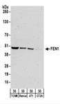 FEN1 Antibody - Detection of Mouse F en1 by Western Blot. Samples: Whole cell lysate (50 ug) from TCMK-1, Renca, 4T1, and CT26.WT cells. Antibodies: Affinity purified rabbit anti-Fen1 antibody used for WB at 0.2 ug/ml. Detection: Chemiluminescence with an exposure time of 3 minutes.