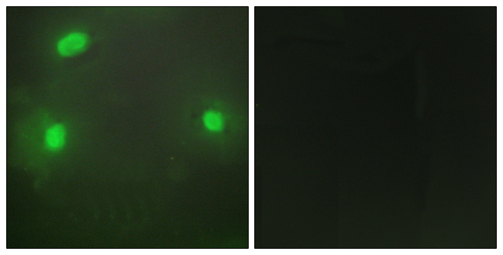 FEN1 Antibody - Immunofluorescence analysis of HeLa cells, using FEN1 Antibody. The picture on the right is blocked with the synthesized peptide.