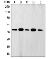 FEN1 Antibody - Western blot analysis of FEN1 expression in A431 (A); MCF7 (B); U937 (C); NIH3T3 (D); PC12 (E) whole cell lysates.