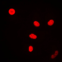 FEN1 Antibody - Immunofluorescent analysis of FEN1 staining in MCF7 cells. Formalin-fixed cells were permeabilized with 0.1% Triton X-100 in TBS for 5-10 minutes and blocked with 3% BSA-PBS for 30 minutes at room temperature. Cells were probed with the primary antibody in 3% BSA-PBS and incubated overnight at 4 C in a humidified chamber. Cells were washed with PBST and incubated with a DyLight 594-conjugated secondary antibody (red) in PBS at room temperature in the dark. DAPI was used to stain the cell nuclei (blue).