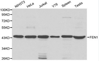 FEN1 Antibody - Western blot of FEN1 pAb in extracts from NIH3T3, Hela, Jurkat, Y79 cells and mouse spleen, testis tissues.