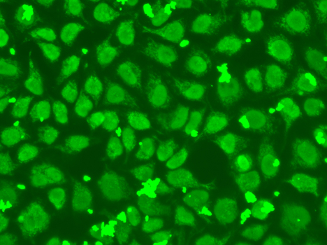 FEN1 Antibody - Immunofluorescence analysis of HeLa cells.